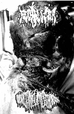 Fecalizer : Fecalizer - Hydropneumothorax